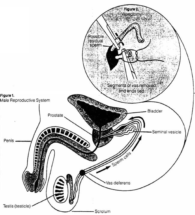vasectomy Vasectomy Explained Figure 1 and 2